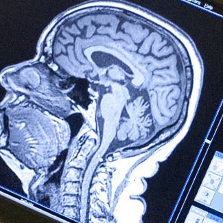 computer monitor with image of brain scan