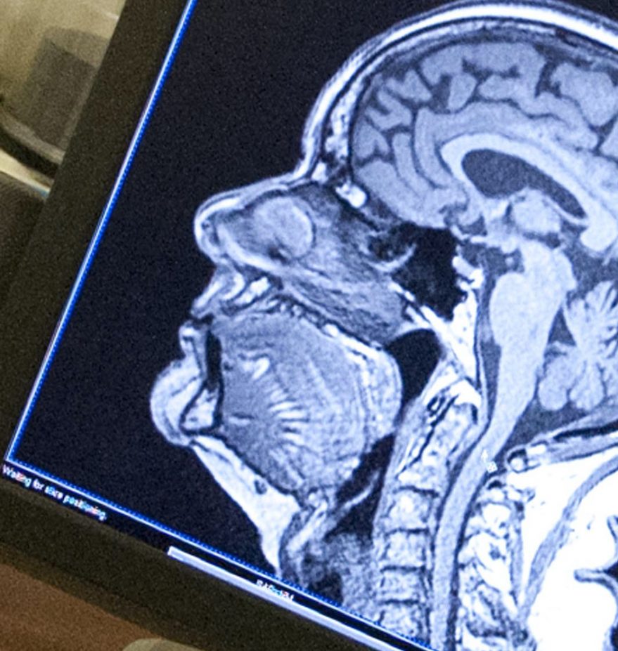 computer monitor with image of brain scan